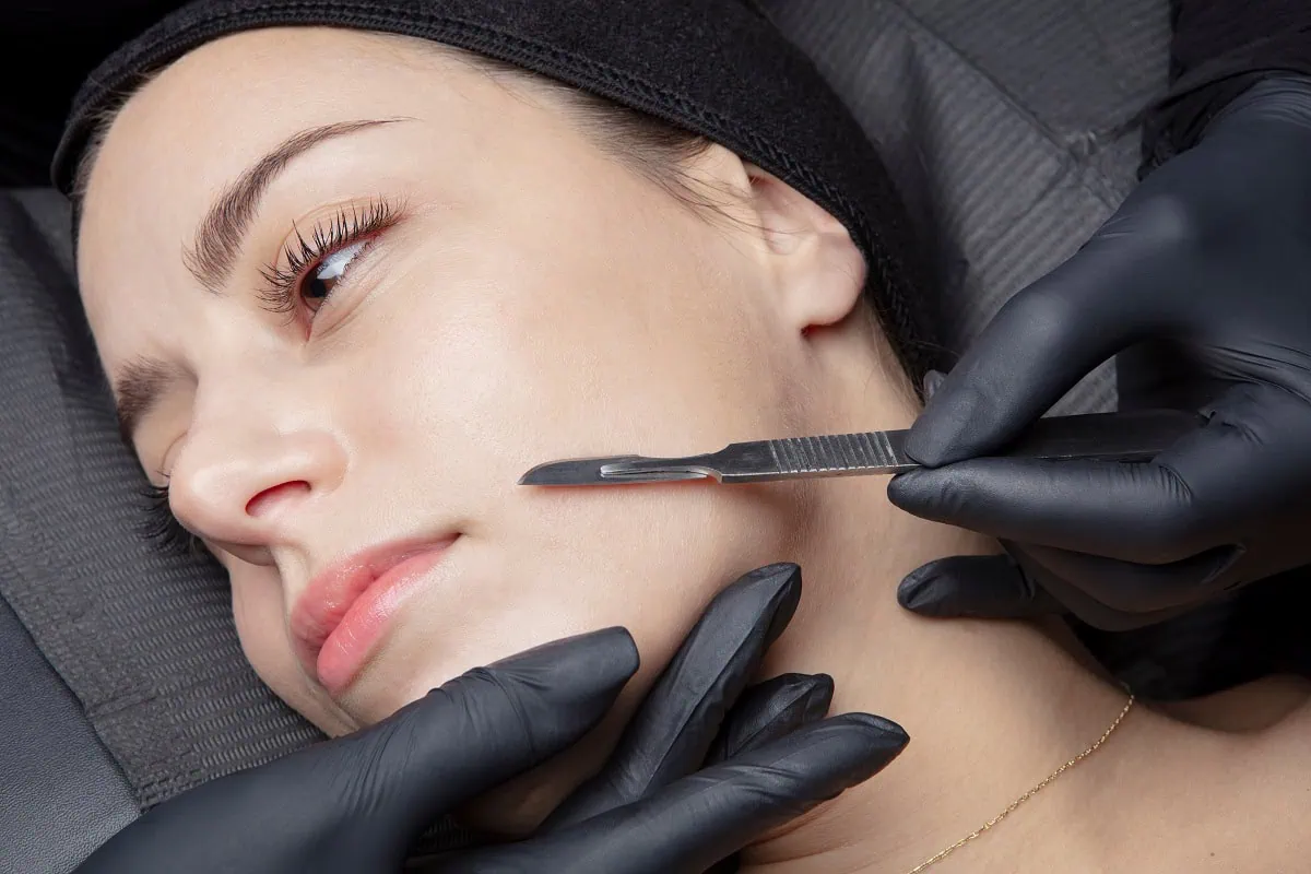 Benefits of Dermaplaning Treatment