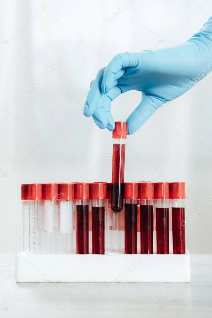Benefits of Lab Service