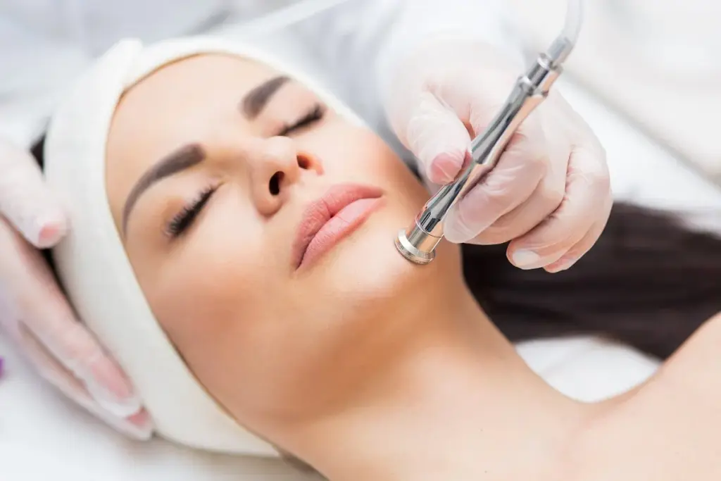 Portfolio 3 Microdermabrasion in Elk Grove