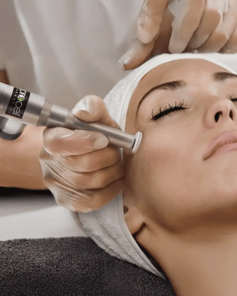 Procell Microchanneling Treatment in Elk Grove CA