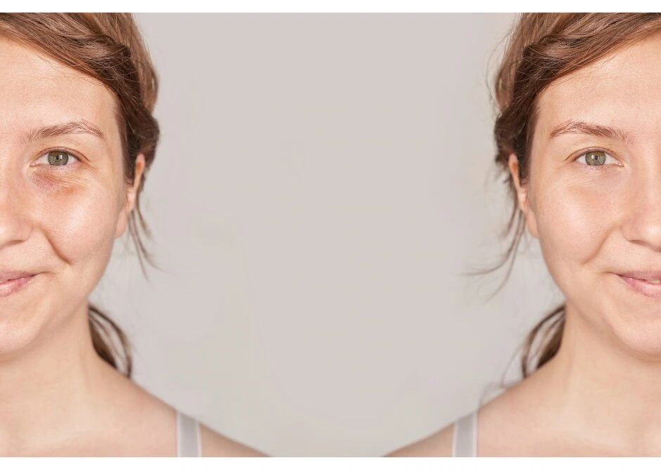 GLUTATHIONE IV TREATMENT
