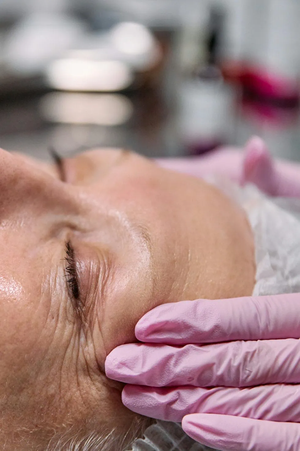 Microneedling for Anti Aging in Sacramento