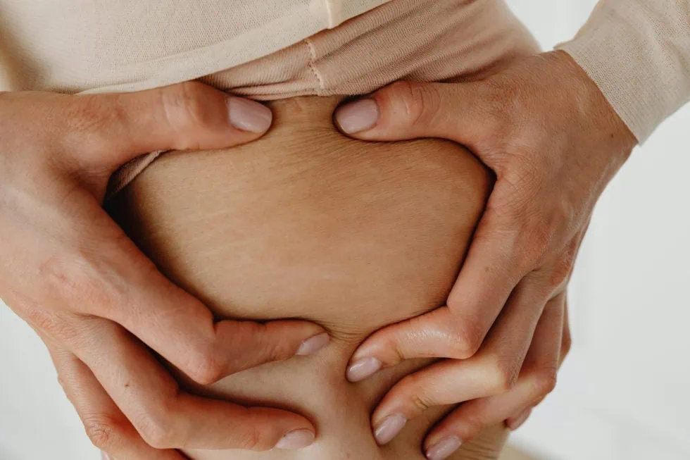 Microneedling for Stretch Marks in Sacramento Does it Work