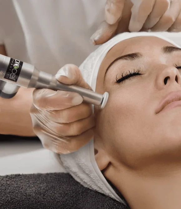 Procell-Microchanneling-Treatment-in-Elk-Grove-CA